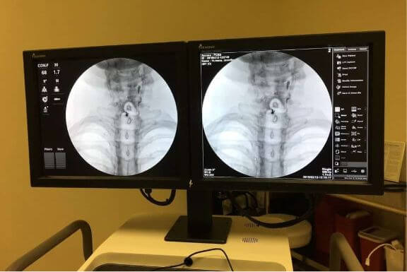 patient neck x-rays